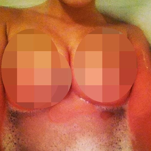 Ηθοποιός ανέβασε κατά λάθος στο Twitter φωτογραφία με το στήθος της   