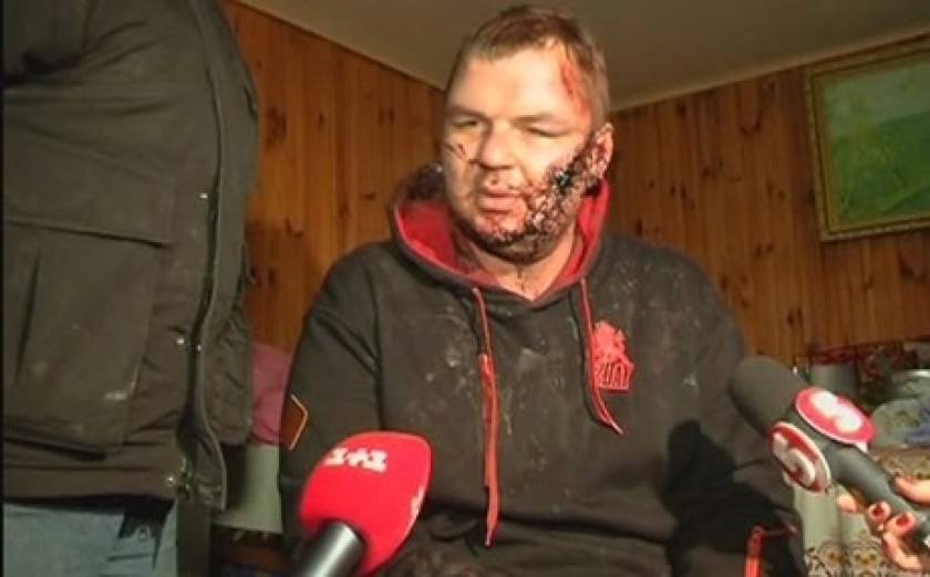 Στη Λιθουανία ο Ουκρανός ακτιβιστής που βασανίστηκε