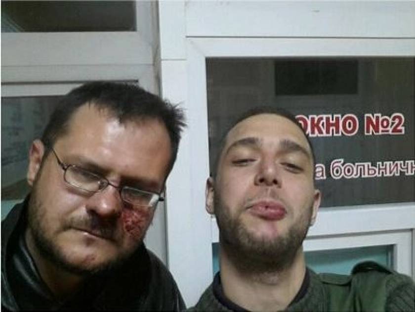 Αυτός είναι ο δημοσιογράφος που δέχθηκε επίθεση στην Κριμαία (pic)!