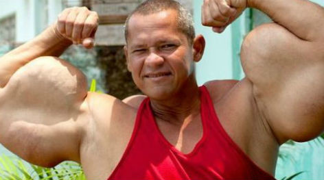 Ο βραζιλιάνος Ποπάι φλερτάρει με το θάνατο - Δείτε πώς έχει γίνει!