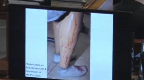 Σοκαριστικές εικόνες: Ο Πιστόριους καλυμμένος με αίματα μετά τον φόνο