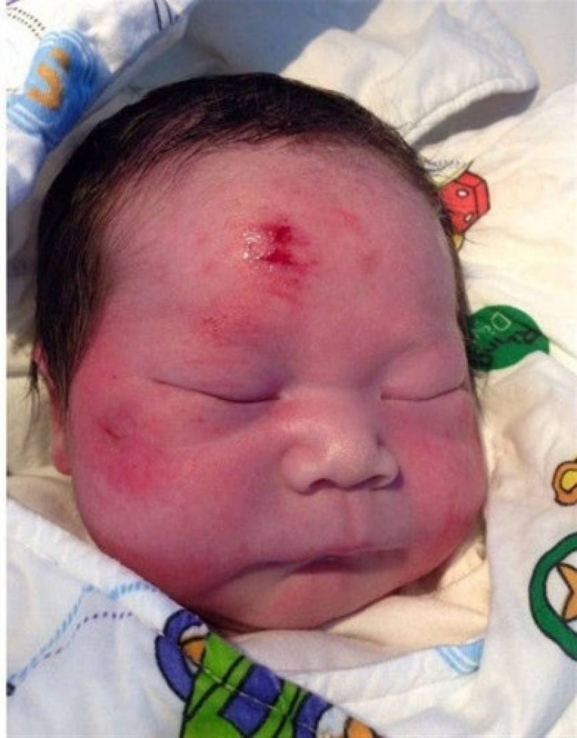 Μωρό γεννήθηκε λίγη ώρα αφότου η μητέρα του σκοτώθηκε σε τροχαίο