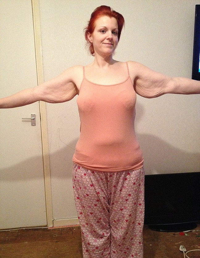 Εντυπωσιακή μεταμόρφωση: Έχασε 102 κιλά όταν... (photos)