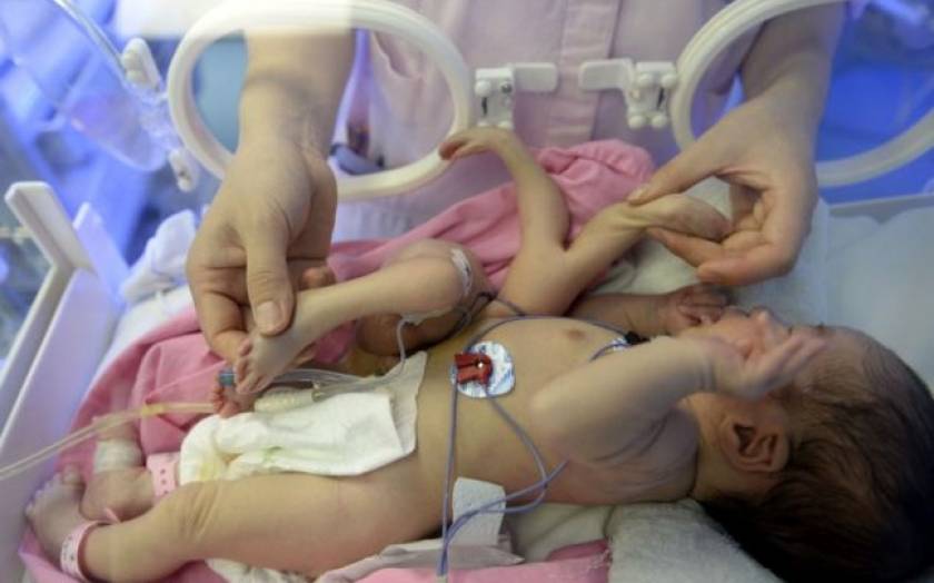 Εικόνες που σοκάρουν: Μωρό γεννήθηκε με 8 άκρα