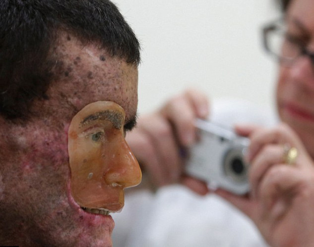 Φωτογραφίες που σοκάρουν: Οι κάτοικοι χωριού που λιώνει το δέρμα τους