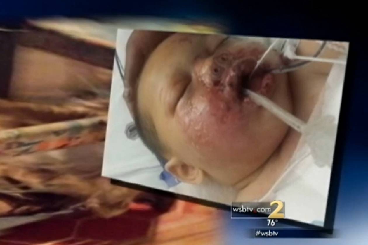 ΗΠΑ: Αστυνομικοί πέταξαν χειροβομβίδα στην κούνια μωρού! (photos)
