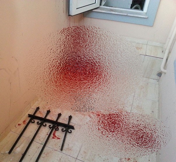 Τραγωδία στη Λέσβο: Έπεσε από μπαλκόνι και καρφώθηκε με το κεφάλι στα κάγκελα