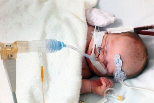 Τραγικό: Έσβησε το μωρό με το καρδιακό πρόβλημα (pics)