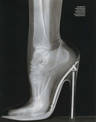 ΣΟΚ: Δείτε μια ακτινογραφία σε γυναικείο πόδι με γόβα...  