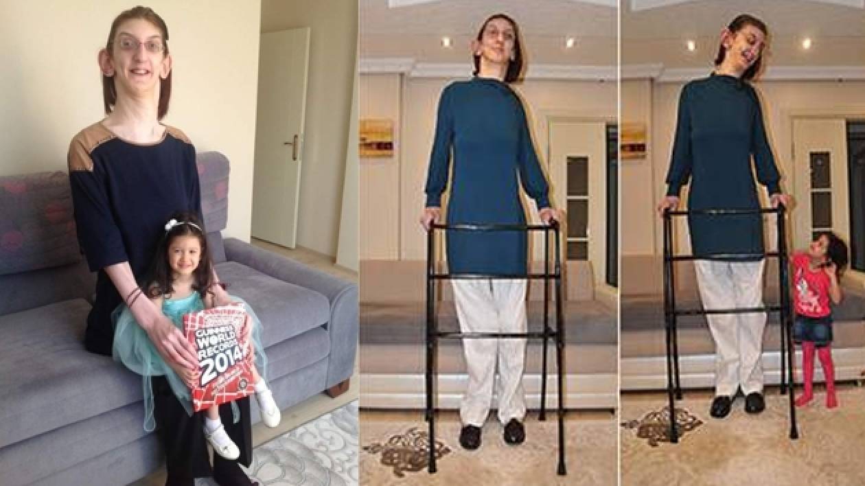 Αυτή είναι η ψηλότερη έφηβη στον κόσμο! (pics)