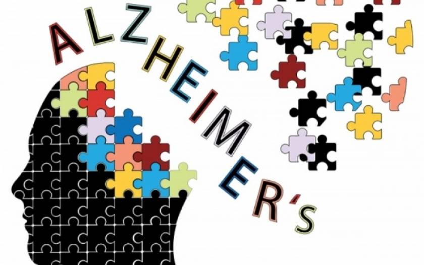 Five questions that reveal sings of early-stage Alzheimer: research