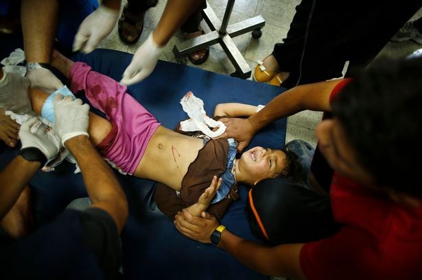 Γάζα: Τα αθώα θύματα από την παράνοια των βομβαρδισμών (video+photos)