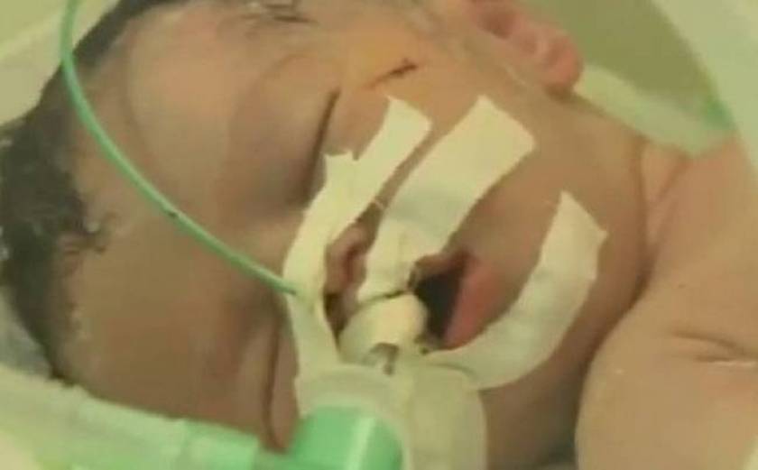 Gaza Strip: Palestinian baby born after mother's death dies