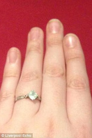 Έπαθε επιληπτική κρίση και της έκλεψαν το διαμαντένιο δαχτυλίδι! (pics)