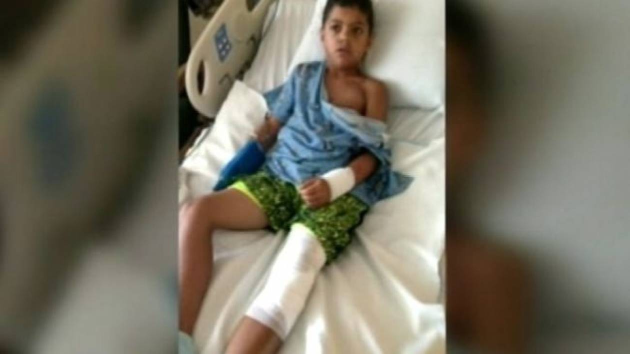 Ενυδρίδα επιτέθηκε και δάγκωσε 8χρονο αγόρι και τη γιαγιά του! (βίντεο)