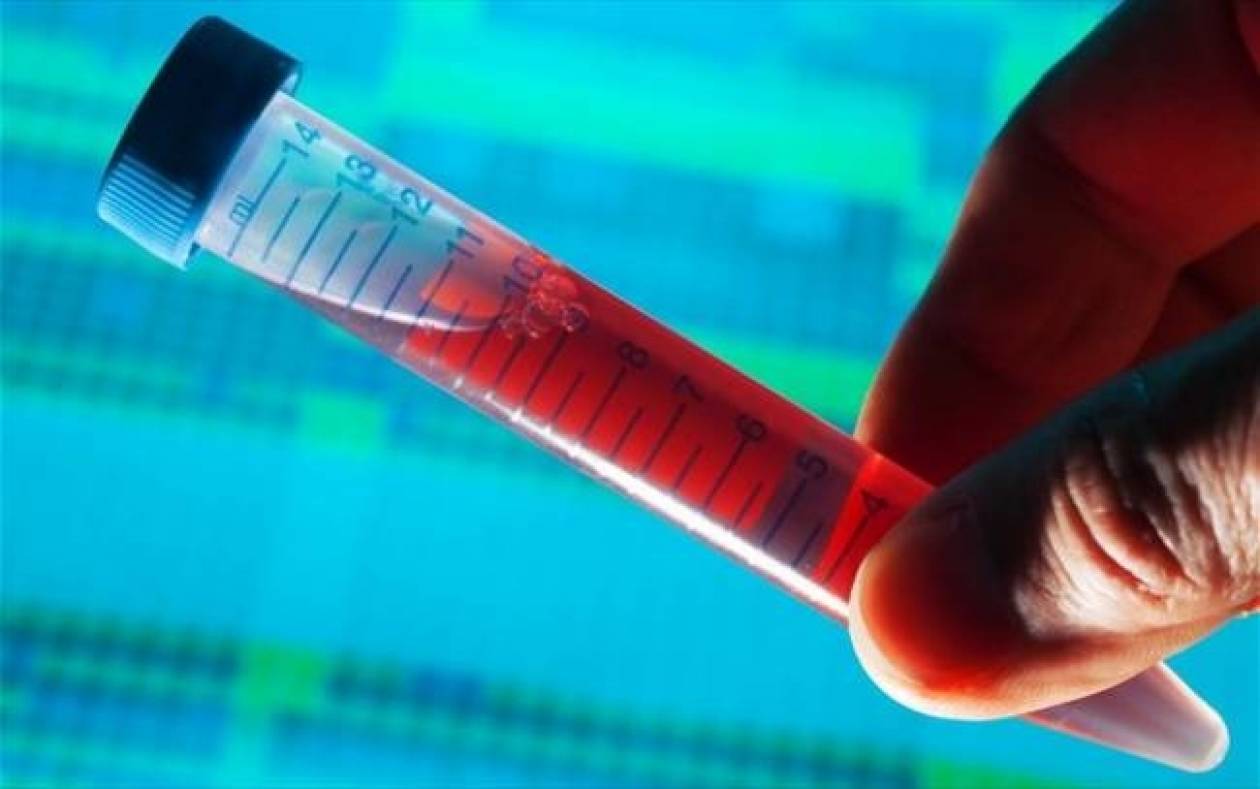 Νέο τεστ αίματος για την ανίχνευση του καρκίνου: επιστημονική έρευνα