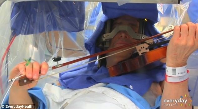ΑΠΙΣΤΕΥΤΟ: Παίζει βιολί την ώρα που χειρουργείται στον εγκέφαλο (pic-vid)