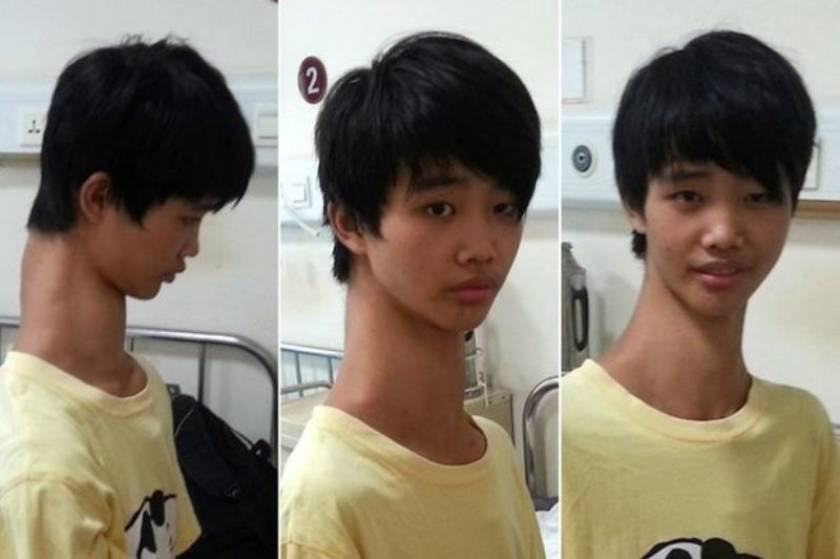 Κίνα: Το αγόρι με το μεγαλύτερο λαιμό στον κόσμο! (photos)