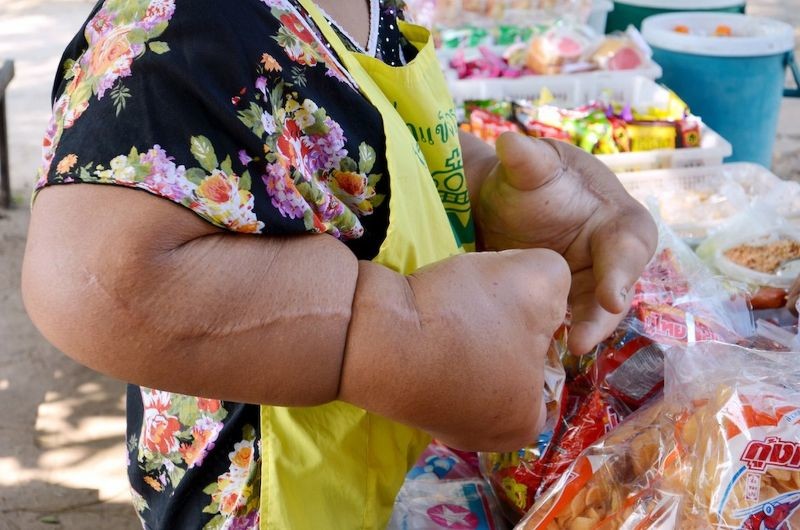  Ταϋλάνδη: Η γυναίκα με τα μεγαλύτερα χέρια στον κόσμο (photos)