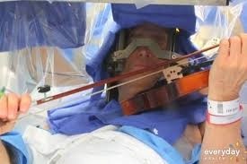 Γυναίκα χειρουργήθηκε στον εγκέφαλο ξύπνια ενώ έπαιζε... βιολί! (pics+video)