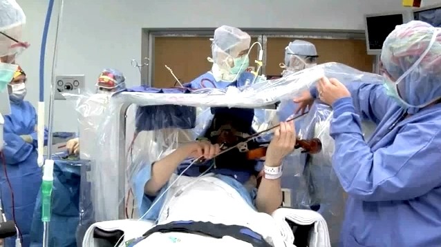 Γυναίκα χειρουργήθηκε στον εγκέφαλο ξύπνια ενώ έπαιζε... βιολί! (pics+video)