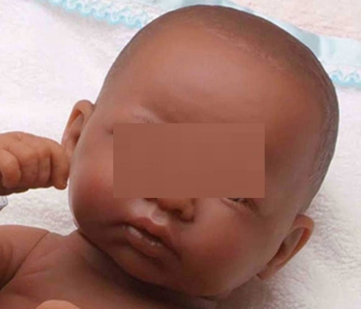 Λευκή γυναίκα που γέννησε μαύρο μωρό μηνύει τράπεζα σπέρματος