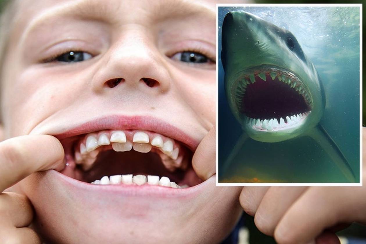 Βρετανία: Αγοράκι… καρχαρίας μάς δείχνει τα δόντια του! (pics)