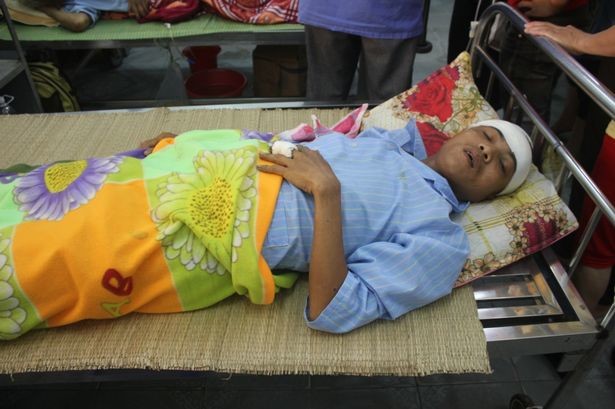 Βιετναμέζος κατέληξε στο νοσοκομείο με δύο καρφιά στο κρανίο του! (pics)