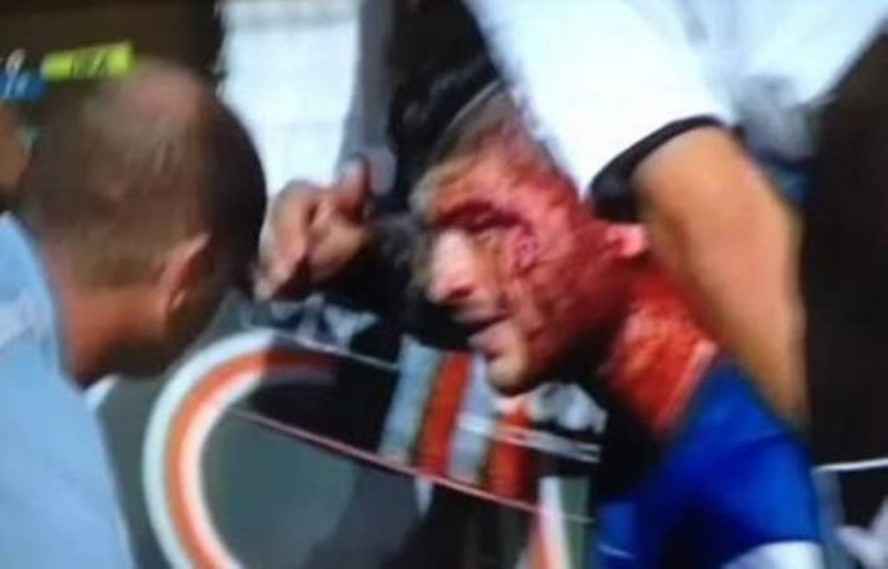 Ανατριχιαστικός τραυματισμός σε αγώνα της Football League (videos)