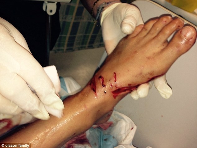 13χρονη δέχτηκε επίθεση από καρχαρία (σκληρές εικόνες- βίντεο)