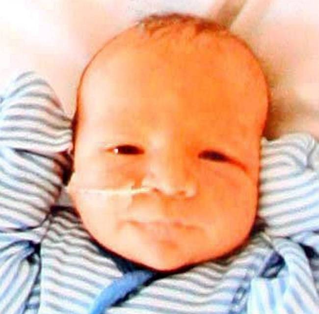 Βρετανία: Πέθανε το μωρό με τη μισή καρδιά (pics)