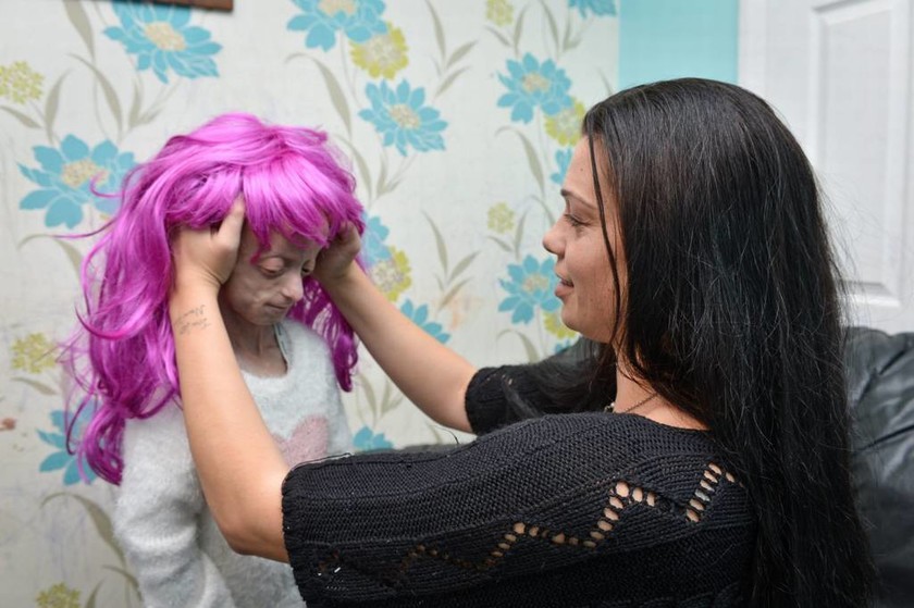 Δάσκαλοι ζήτησαν από άρρωστη μαθήτρια να βγάλει την περούκα της