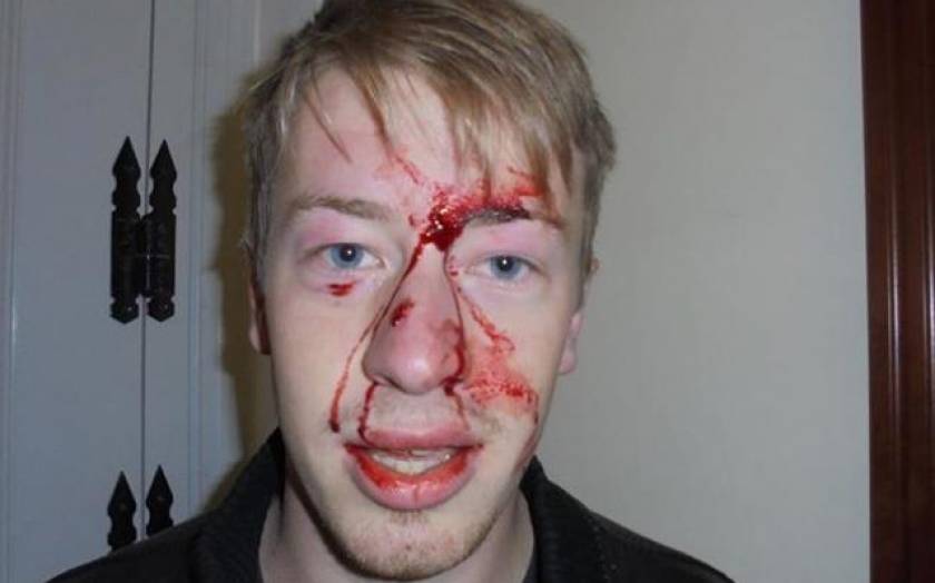 Γερμανός φοιτητής καταγγέλλει ξυλοδαρμό από τα ΜΑΤ (pic)