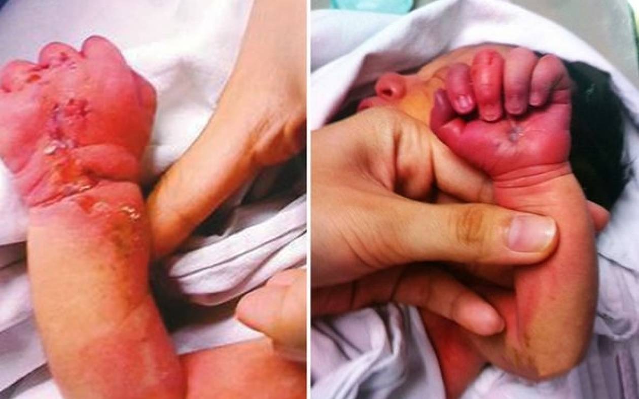 Κίνα: Κανίβαλος προσπάθησε να φάει το νεογέννητο μωρό της!