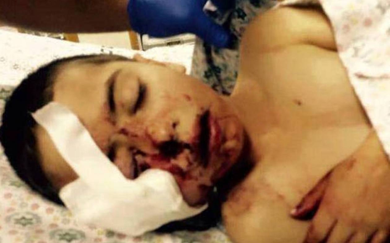 Ισραήλ: Αστυνομικός πυροβόλησε 5χρονο στο πρόσωπο