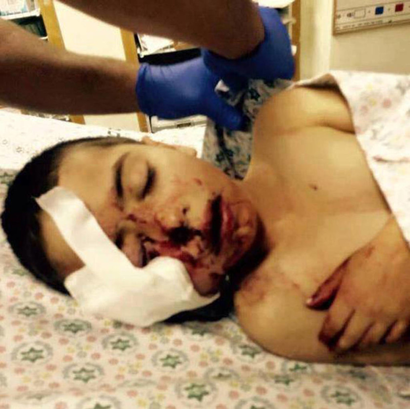 Ισραήλ: Αστυνομικός πυροβόλησε 5χρονο στο πρόσωπο