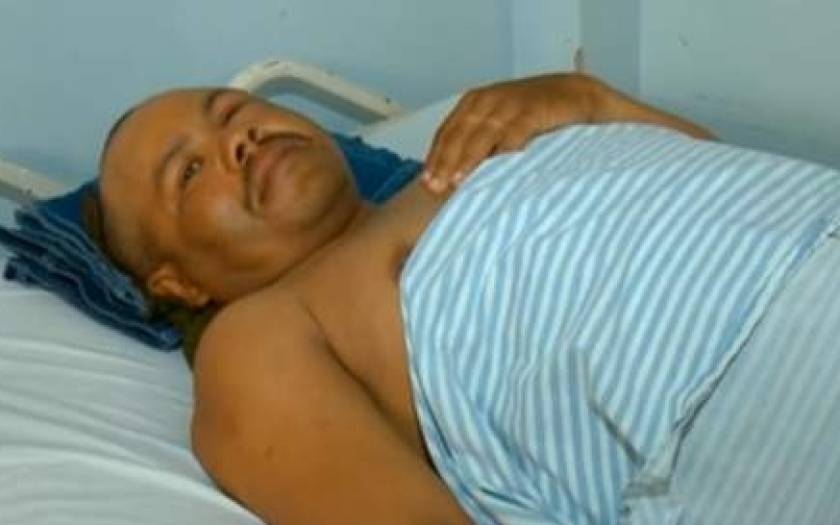 Βραζιλία: Διένυσε 100 χλμ με ένα μαχαίρι καρφωμένο στο κεφάλι! (photo)
