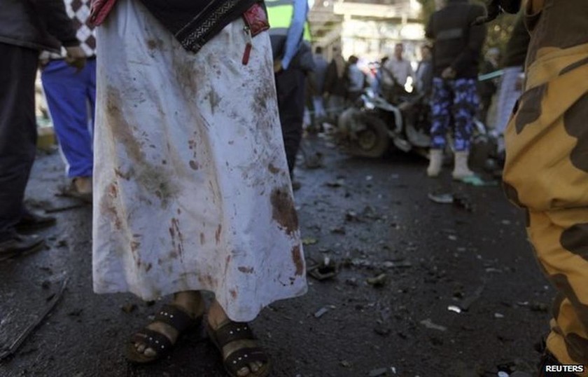Υεμένη: 33 νεκροί και 62 από έκρηξη παγιδευμένου αυτοκινήτου (pics)