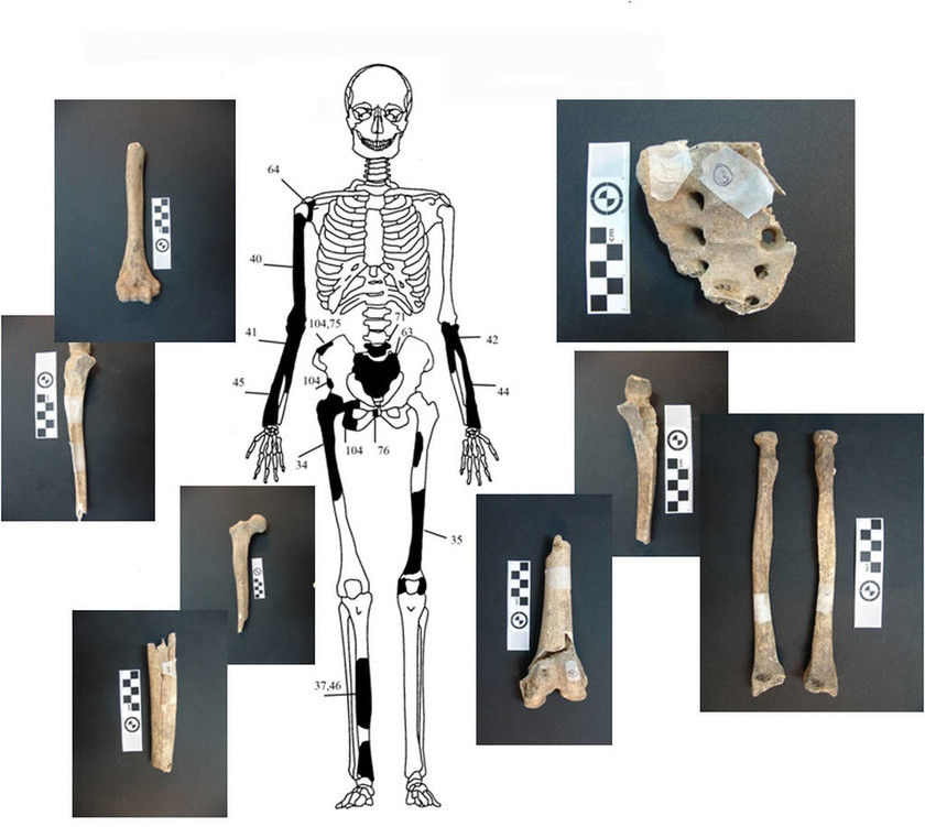 Αμφίπολη: Συγκλονιστικές φωτογραφίες - Πέντε τελικά οι σκελετοί! (pics)