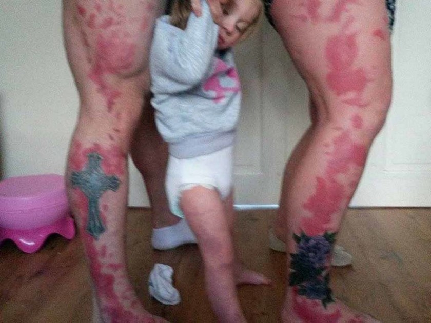 Συγκινητικό: Έκαναν τατουάζ τα σημάδια της κόρης τους (pics)