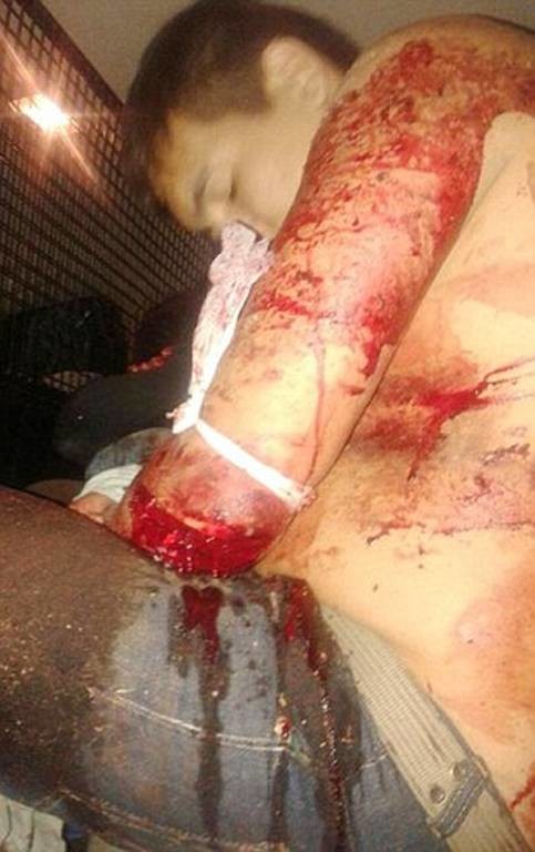 Αργεντινή: «Υποδέχτηκε» τους ληστές με σπαθί σαμουράι (σκληρές εικόνες) 