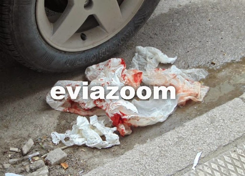 Φρικτό ατύχημα στη Χαλκίδα: Αστικό λεωφορείο έκοψε τα δάχτυλα νεαρής γυναίκας (vid)