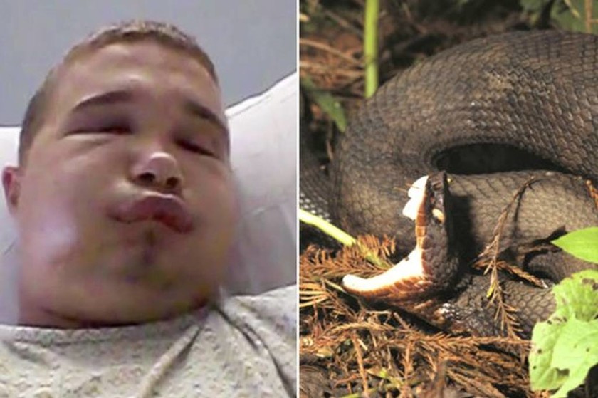 Πήγε να... φιλήσει ένα δηλητηριώδες φίδι και δείτε πώς έγινε! (photo)