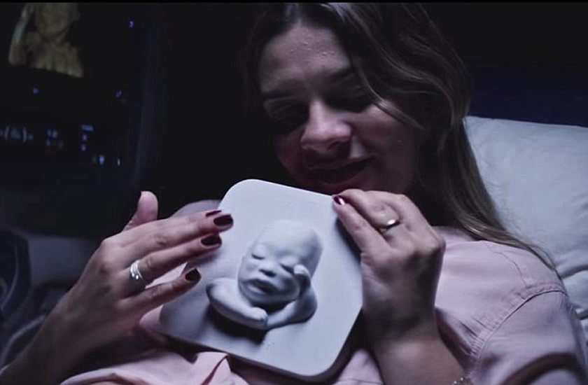 Τυφλή μητέρα «είδε» το αγέννητο μωρό της με τα χέρια της (video)