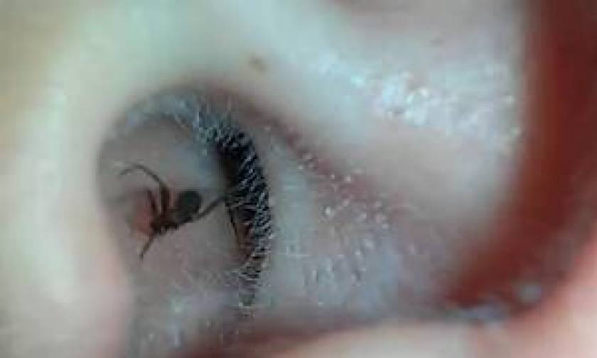 Η στιγμή που είδε ότι μια αράχνη «μαύρη χήρα» ζούσε στο... αυτί του! (video)