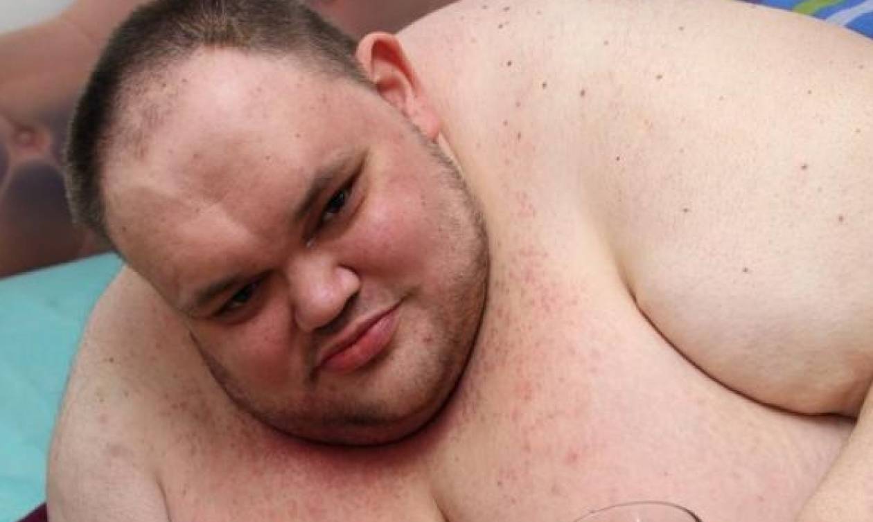 Έφυγε από τη ζωή ο πιο παχύσαρκος Βρετανός (photos)