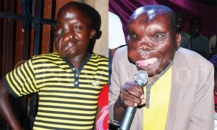 O πιο άσχημος άνδρας της Ουγκάντα έχει οκτώ παιδιά! (photos+videos)