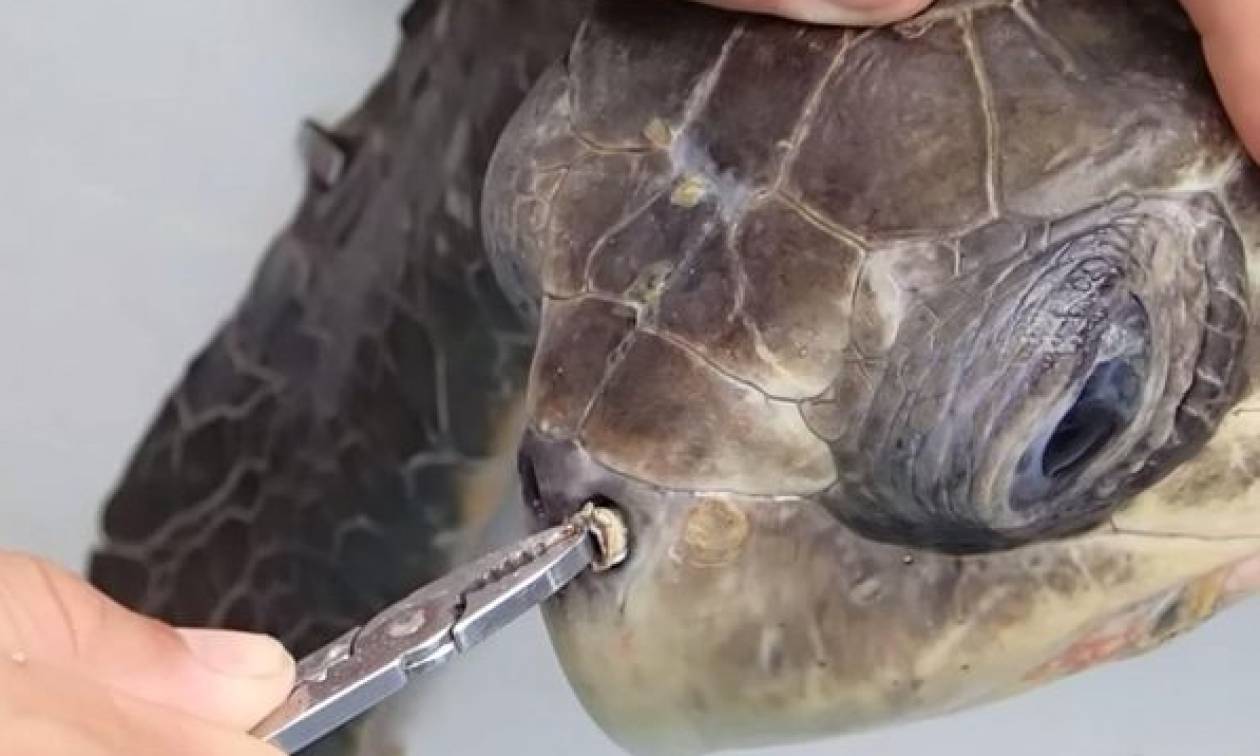 Γι΄ αυτό δεν πρέπει να πετάτε σκουπίδια στη θάλασσα – Δείτε τι αφαίρεσαν από το ρουθούνι χελώνας!