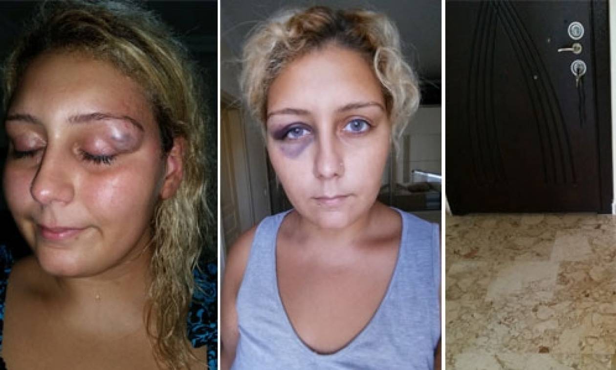 «Εκβίασε» τη σύλληψη του πρώην της ανεβάζοντας φωτογραφίες της κακοποίησής της