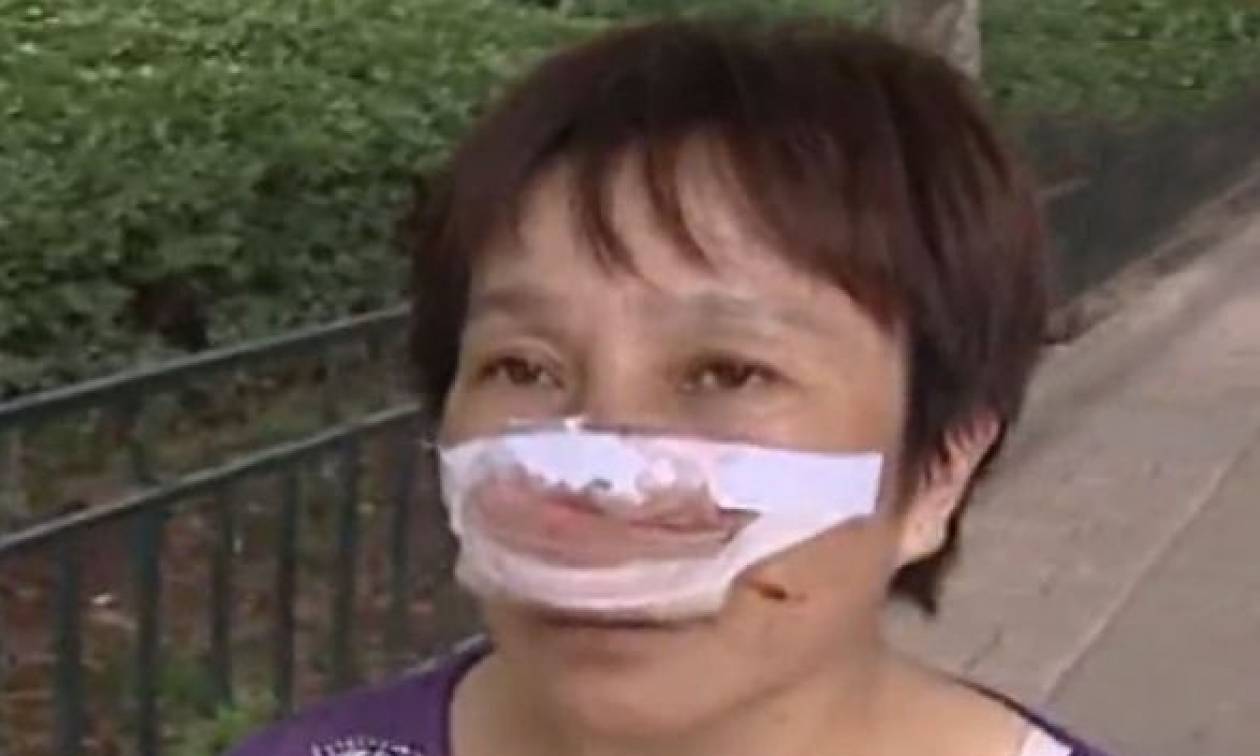 Φρικιαστική επίθεση: Της έκοψε τη μύτη με τα δόντια και την κατάπιε! (video)